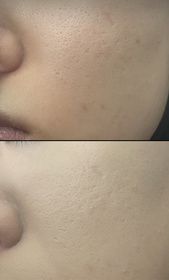 Ice-shu uemura 植村秀unlimited 無限輕透持妝粉底液 (小方瓶 2.0)_2