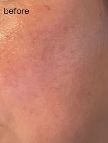 飯焦-OLAY水感透白光曜精華 (#水光小白瓶)_3