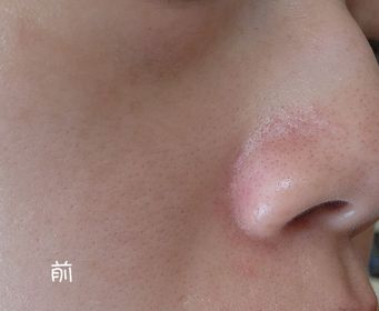 HaloPrettyPig-Charlotte Tilbury夢幻柔光粉氣墊_2