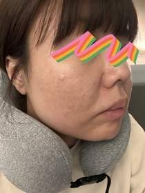 Candy Lau-OLAY水感透白光曜精華 (#水光小白瓶)_3