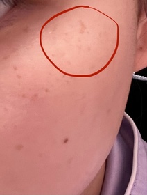 Yoyo Sin-OLAY水感透白光曜精華 (#水光小白瓶)_1