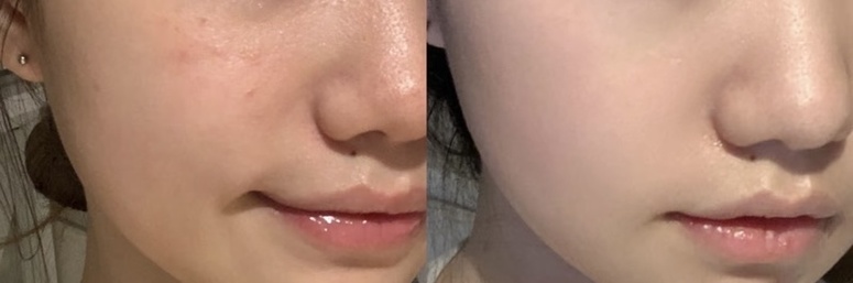 Mmman-LA ROCHE-POSAYMela B3 透光淡斑精華_1