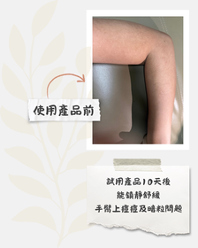 mandyf128-JOSERISTINE 彩豐皮奧寧防痘．身體護理噴霧_2