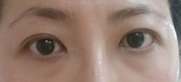 mandy-LANCÔMEGenifique升級版嫩肌活膚眼霜 (發光眼霜)_3