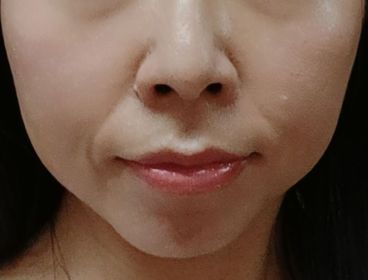 mandy-CHANTECAILLE未來肌膚粉底_4