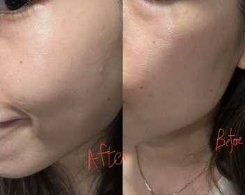 Casscky-OLAY水感透白光曜精華 (#水光小白瓶)_1