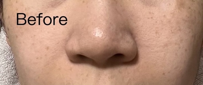 Tina-Dermacept幹細胞緊緻煥顏精華_1