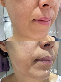AngelC-HADA LABO 肌研H.A. Supreme 透亮活力精萃水_3