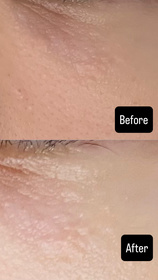 Wendy-HADA LABO 肌研H.A Supreme 緊緻煥亮眼霜_2