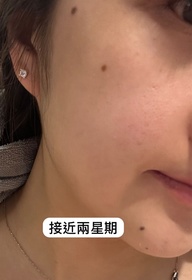 sueman15-HADA LABO 肌研H.A. Supreme 透亮活力精萃水_2