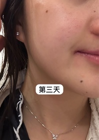 sueman15-HADA LABO 肌研H.A. Supreme 透亮活力精萃水_3