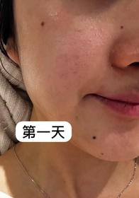 sueman15-HADA LABO 肌研H.A. Supreme 透亮活力精萃水_4
