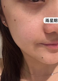 sueman15-HADA LABO 肌研H.A Supreme 緊緻煥亮眼霜_1