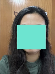 Gamma-HADA LABO 肌研H.A. Supreme 透亮活力精萃水_2