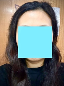 Gamma-HADA LABO 肌研H.A. Supreme 透亮活力精萃水_3