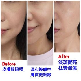 Pinkberry-NIVEALUMINOUS630 專研多重淡斑透白平衡乳液 (630乳液)_4