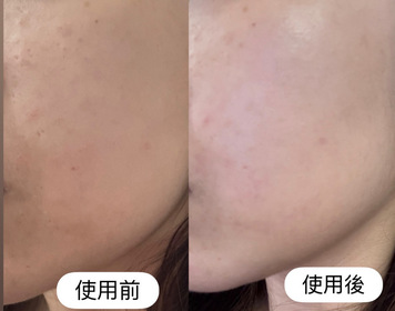Suidan-NIVEALUMINOUS630 專研多重淡斑透白平衡乳液 (630乳液)_3