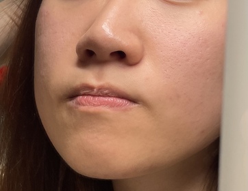 Ice-NIVEALUMINOUS630 專研多重淡斑透白平衡乳液 (630乳液)_1