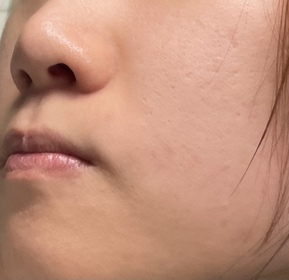 Ice-NIVEALUMINOUS630 專研多重淡斑透白平衡乳液 (630乳液)_2