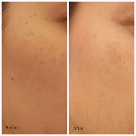 hellolulu-NIVEALUMINOUS630 專研多重淡斑透白平衡乳液 (630乳液)_3