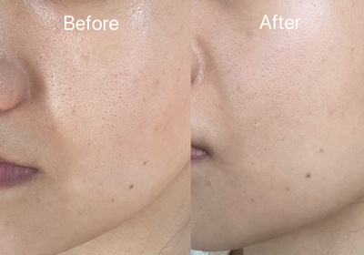 Lunas-NIVEALUMINOUS630 專研多重淡斑透白精華 (630雙能瓶)_2