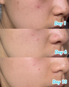 samanthang1117-NIVEALUMINOUS630 專研多重淡斑透白精華 (630雙能瓶)_3