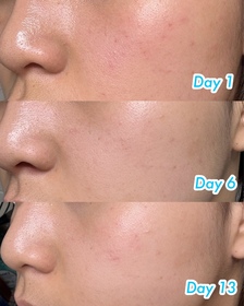 samanthang1117-NIVEALUMINOUS630 專研多重淡斑透白平衡乳液 (630乳液)_1