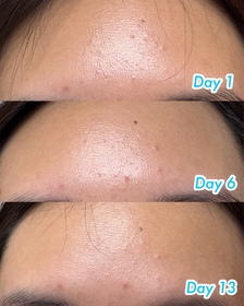 samanthang1117-NIVEALUMINOUS630 專研多重淡斑透白平衡乳液 (630乳液)_4