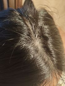 Evelyn-YVES ROCHER頭皮修護精華 _2