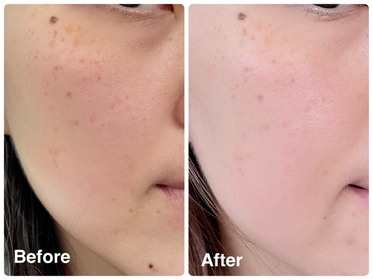 Meric-NIVEALUMINOUS630 專研多重淡斑透白煥膚精華水 (630精華水)_1