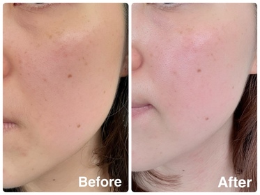 Meric-NIVEALUMINOUS630 專研多重淡斑透白煥膚精華水 (630精華水)_2