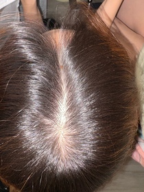 Rachel Hui-YVES ROCHER頭皮修護精華 _3