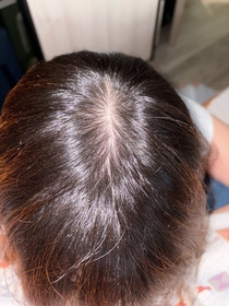 Rachel Hui-YVES ROCHER頭皮修護精華 _4