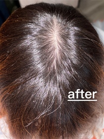 Rachel Hui-YVES ROCHER防脫豐盈精華_3