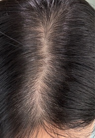 KDing-YVES ROCHER防脫豐盈精華_2