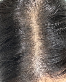 KDing-YVES ROCHER防脫豐盈精華_3