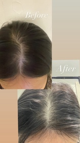 Lok-YVES ROCHER防脫豐盈精華_1