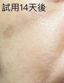 Kaufmann-NIVEALUMINOUS630 專研多重淡斑透白平衡乳液 (630乳液)_1