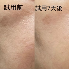 Kaufmann-NIVEALUMINOUS630 專研多重淡斑透白平衡乳液 (630乳液)_2