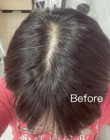 CandyLiYing-YVES ROCHER頭皮修護精華 _2