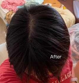 CandyLiYing-YVES ROCHER頭皮修護精華 _4