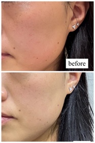 Leonon-NIVEALUMINOUS630 專研多重淡斑透白精華 (630雙能瓶)_2