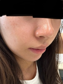 natalieho1202-NIVEALUMINOUS630 專研多重淡斑透白精華 (630雙能瓶)_3