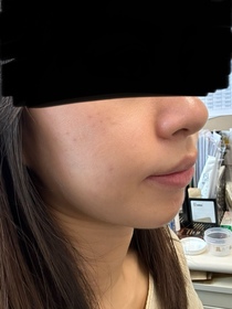 natalieho1202-NIVEALUMINOUS630 專研多重淡斑透白煥膚精華水 (630精華水)_4