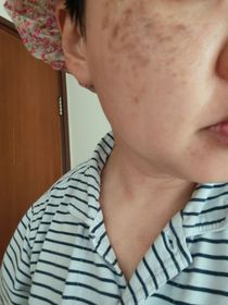 TongTong-LA ROCHE-POSAYMela B3 透光淡斑精華_1