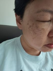 TongTong-LA ROCHE-POSAYMela B3 透光淡斑精華_3