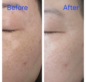 JuneL-LA ROCHE-POSAYMela B3 透光淡斑精華_4