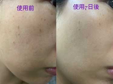 Viannie-LA ROCHE-POSAYANTHELIOS UVMUNE 400全效廣譜輕盈隔離乳液 【抗斑配方】_3