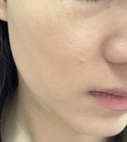 Rin-Benefit反孔精英無PORE粉底_1