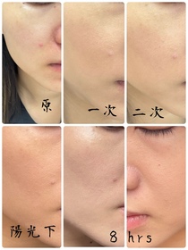 Rin-Benefit反孔精英無PORE粉底_2